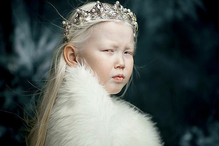 10 фото очень красивой якутской девочки-альбиноса